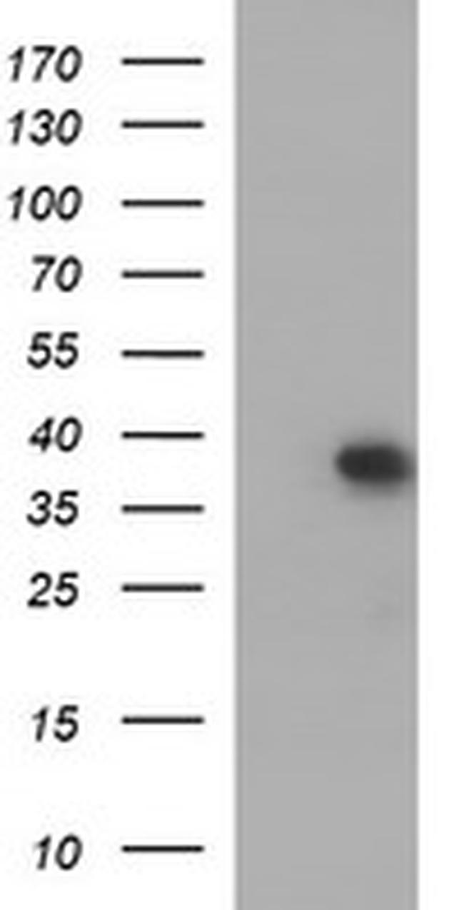 MCAT Antibody in Western Blot (WB)