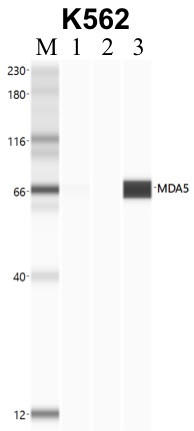 MDA5 Antibody in Immunoprecipitation (IP)