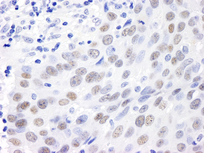 MDC1 Antibody in Immunohistochemistry (IHC)