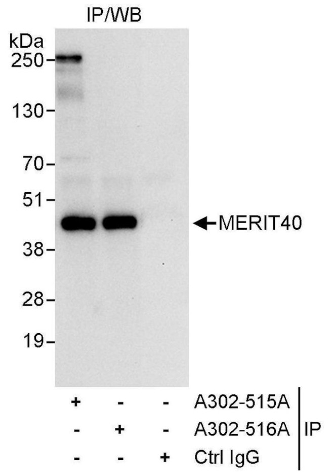 MERIT40 Antibody in Immunoprecipitation (IP)