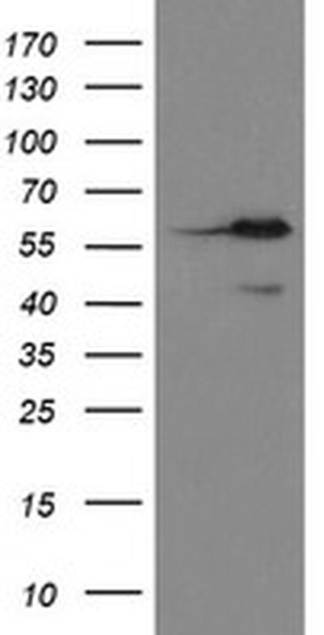 METAP2 Antibody in Western Blot (WB)