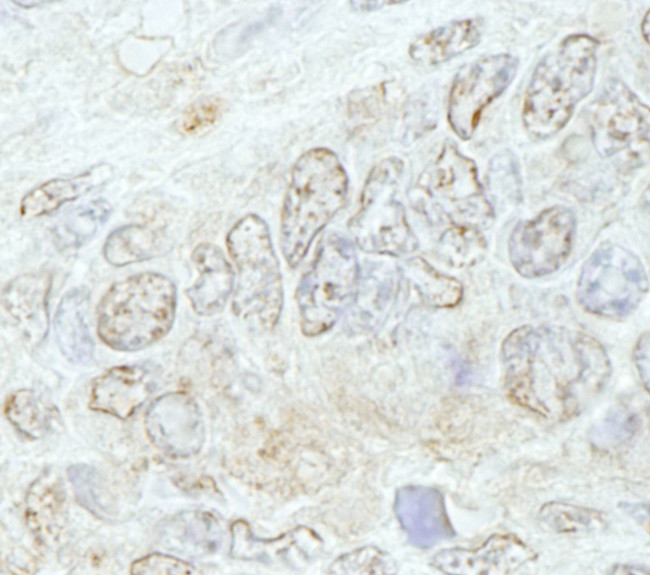 METTL3/MT-A70 Antibody in Immunohistochemistry (IHC)