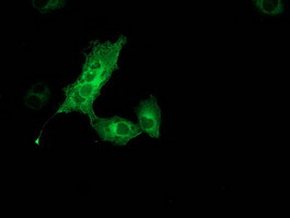 MGLL Antibody in Immunocytochemistry (ICC/IF)