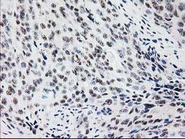 MGLL Antibody in Immunohistochemistry (Paraffin) (IHC (P))