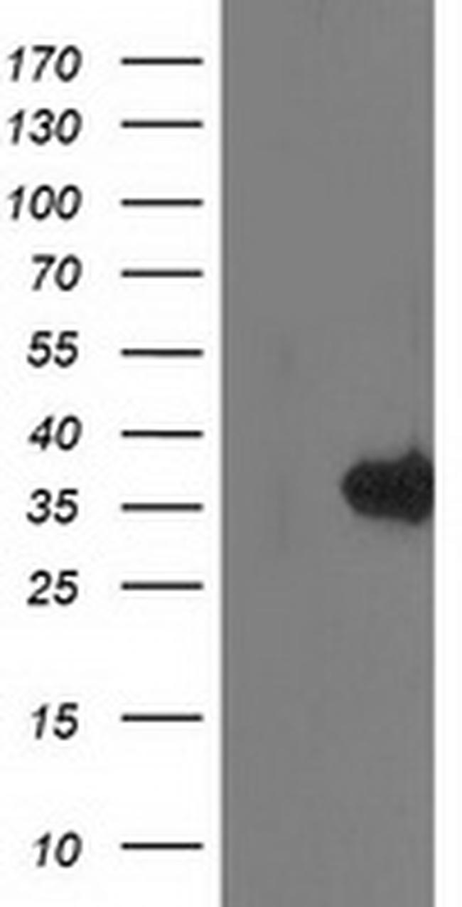 MGLL Antibody in Western Blot (WB)