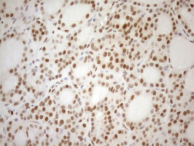 MGMT Antibody in Immunohistochemistry (Paraffin) (IHC (P))