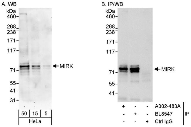 MIRK Antibody in Western Blot (WB)