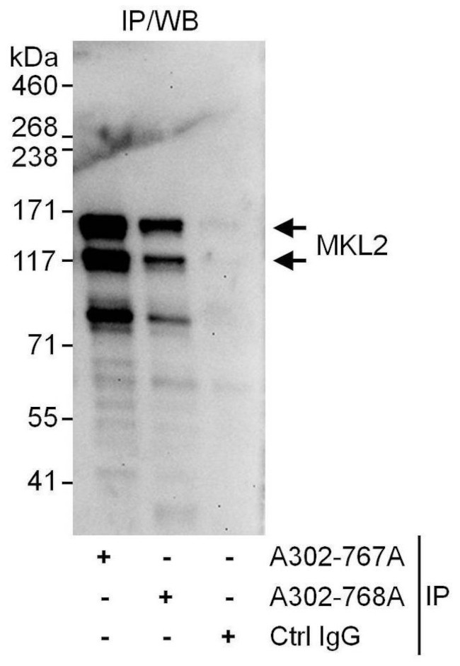 MKL2 Antibody in Immunoprecipitation (IP)