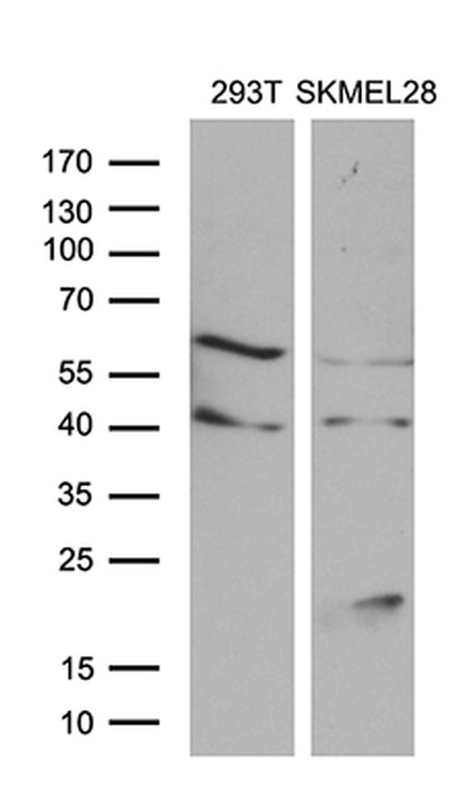 MLANA Antibody in Western Blot (WB)