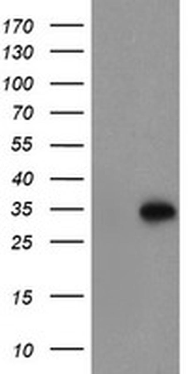 MLF1 Antibody in Western Blot (WB)