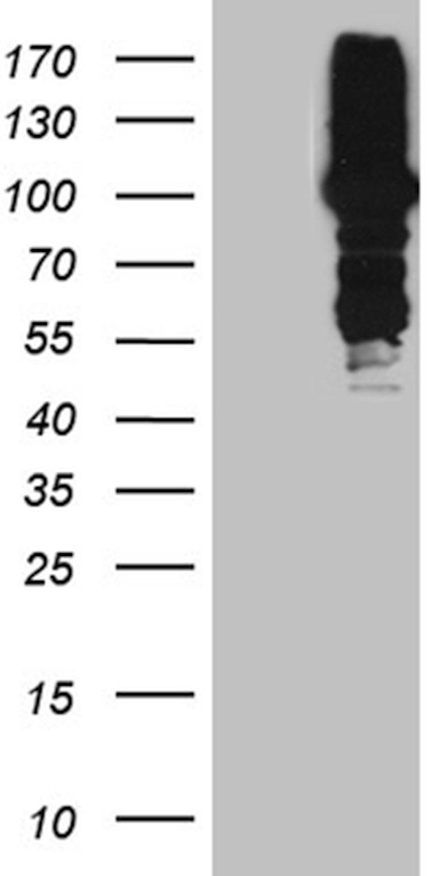 MLH1 Antibody in Western Blot (WB)