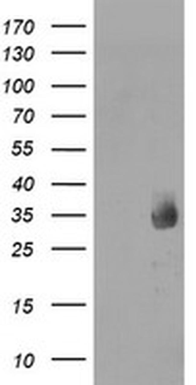 MMACHC Antibody in Western Blot (WB)