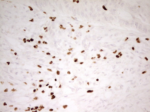 MNDA Antibody in Immunohistochemistry (Paraffin) (IHC (P))
