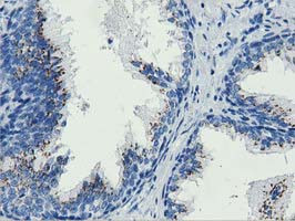 MOBKL1A Antibody in Immunohistochemistry (Paraffin) (IHC (P))