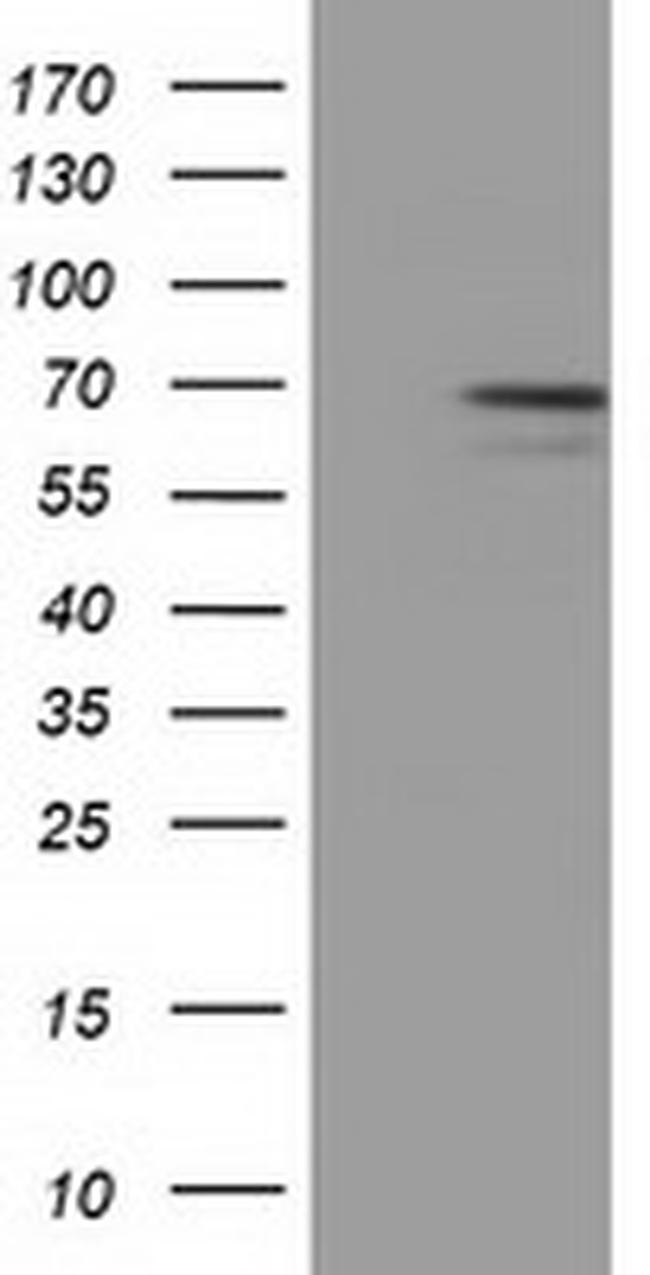 MPP3 Antibody in Western Blot (WB)