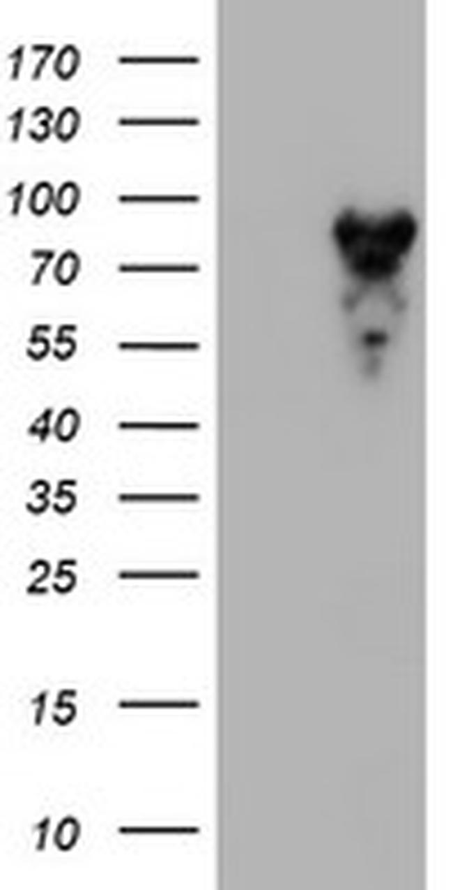 MPP5 Antibody in Western Blot (WB)