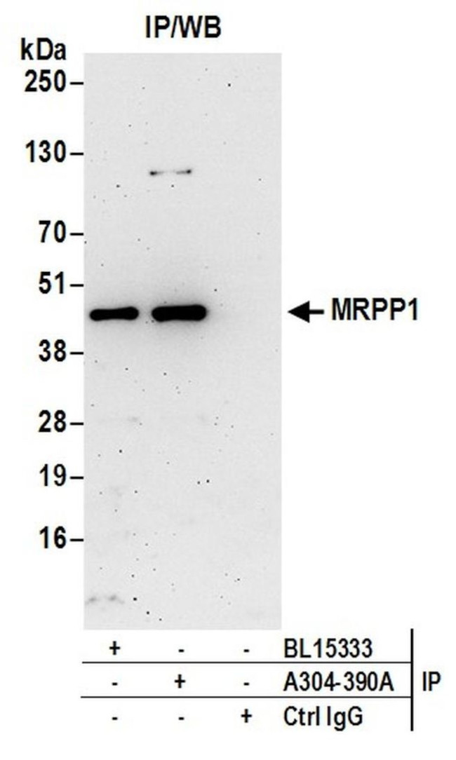 MRPP1 Antibody in Immunoprecipitation (IP)