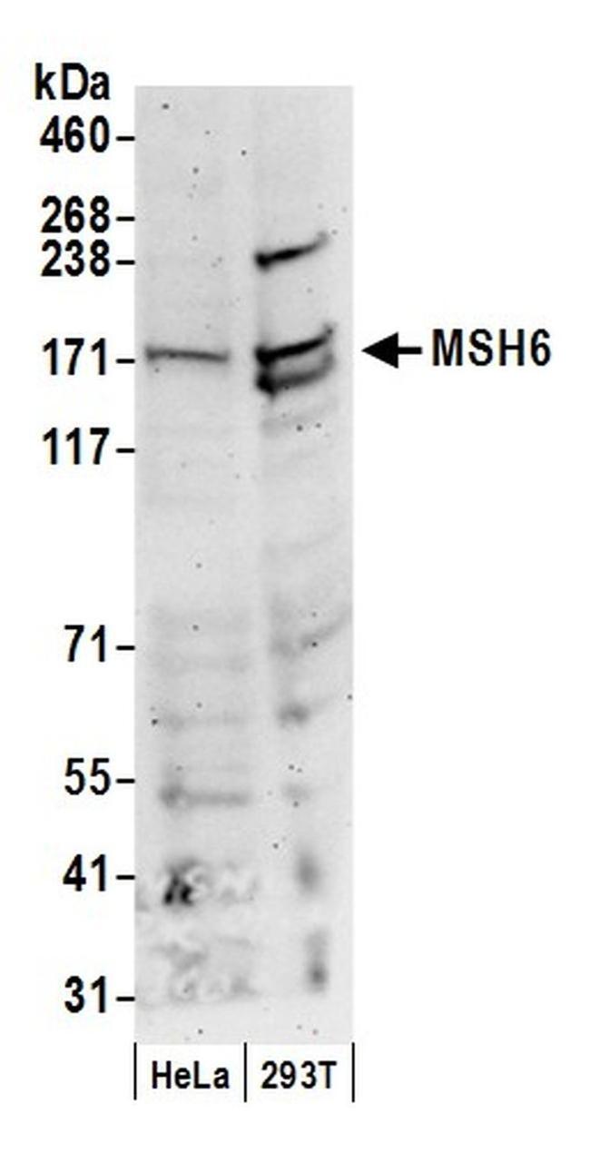 MSH6 Antibody in Western Blot (WB)