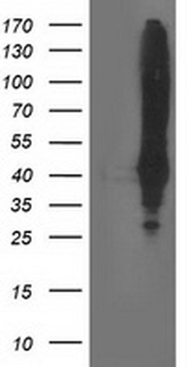 MSI1 Antibody in Western Blot (WB)