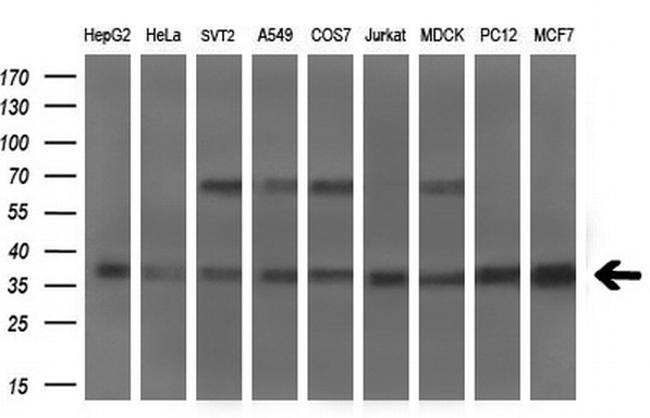 MSI2 Antibody in Western Blot (WB)