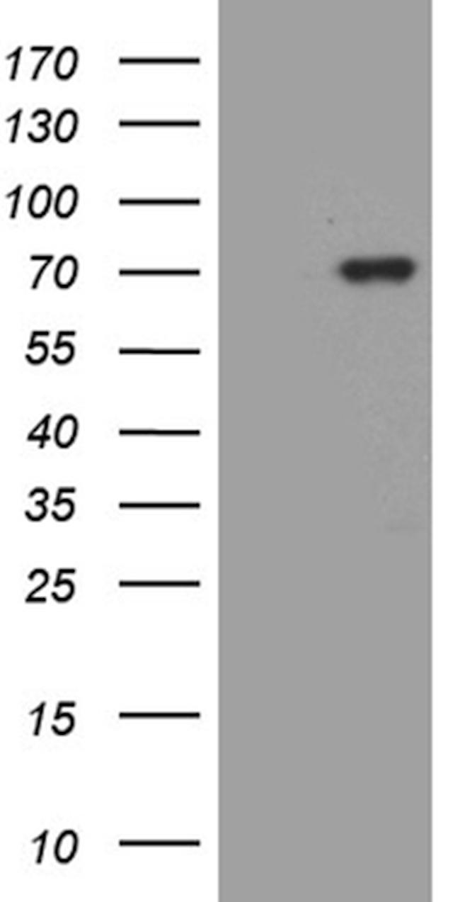 MSL2 Antibody in Western Blot (WB)