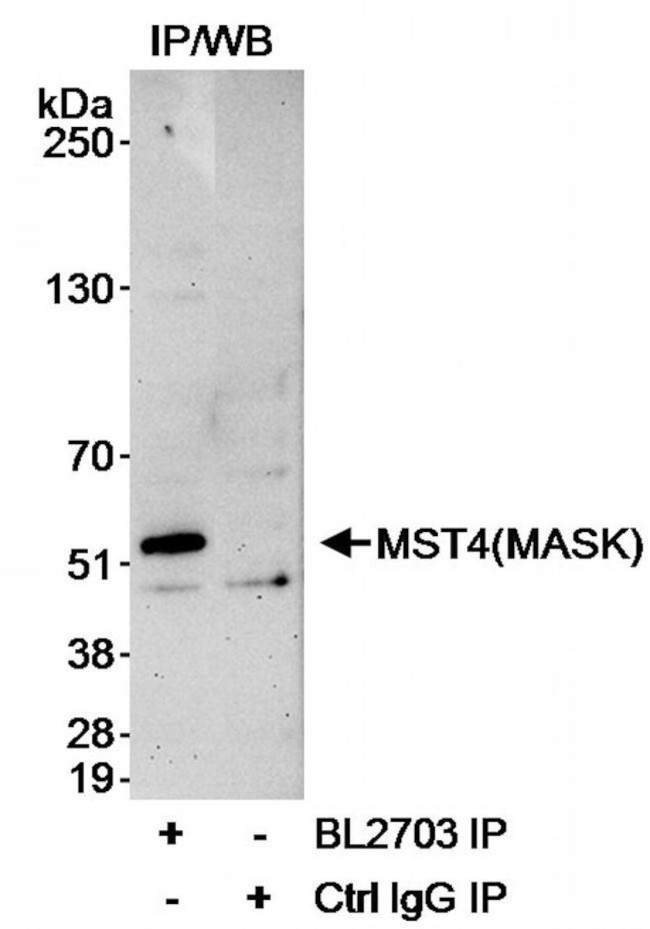 MST4/MASK Antibody in Immunoprecipitation (IP)