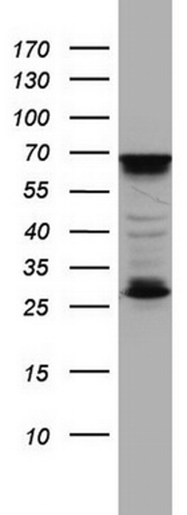 MTDH Antibody in Western Blot (WB)
