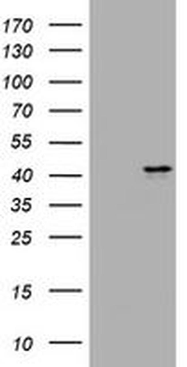 MUC16 Antibody in Western Blot (WB)