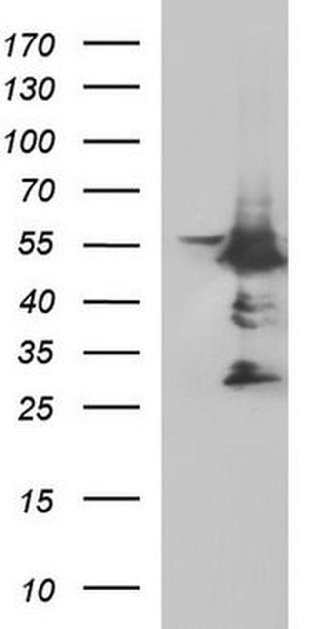MYC Antibody in Western Blot (WB)