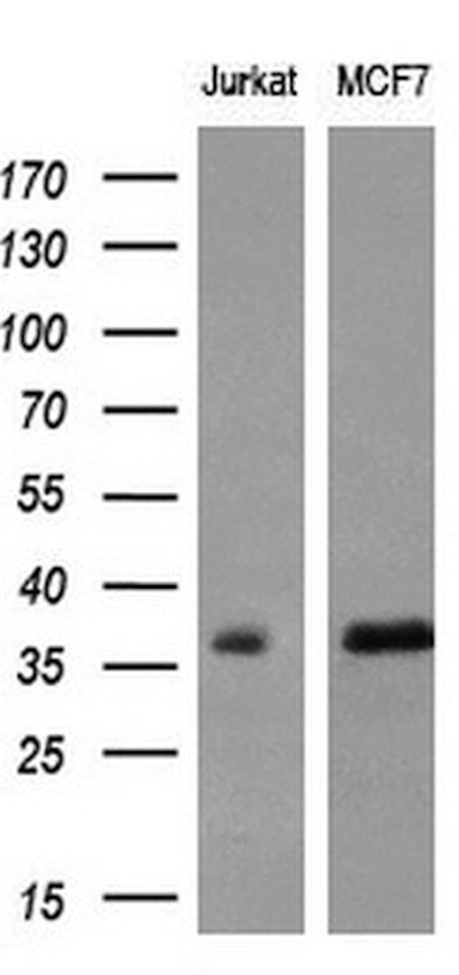 MYD88 Antibody in Western Blot (WB)