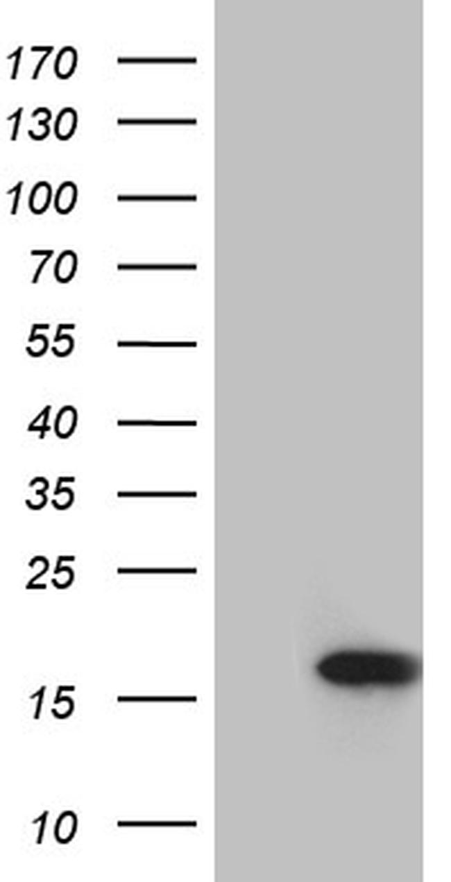 MYL1 Antibody in Western Blot (WB)