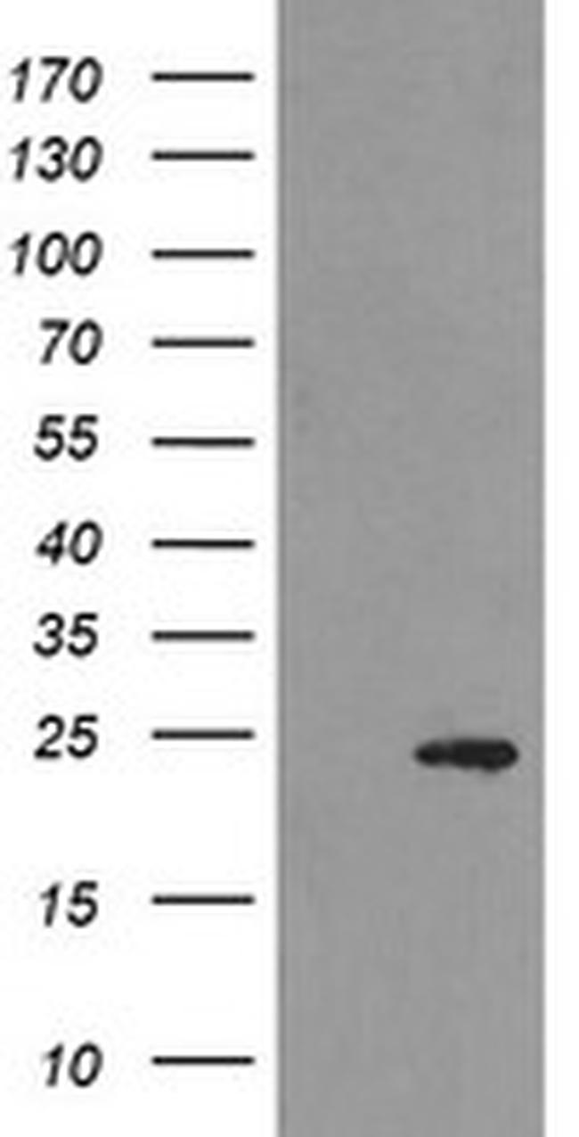MYL7 Antibody in Western Blot (WB)
