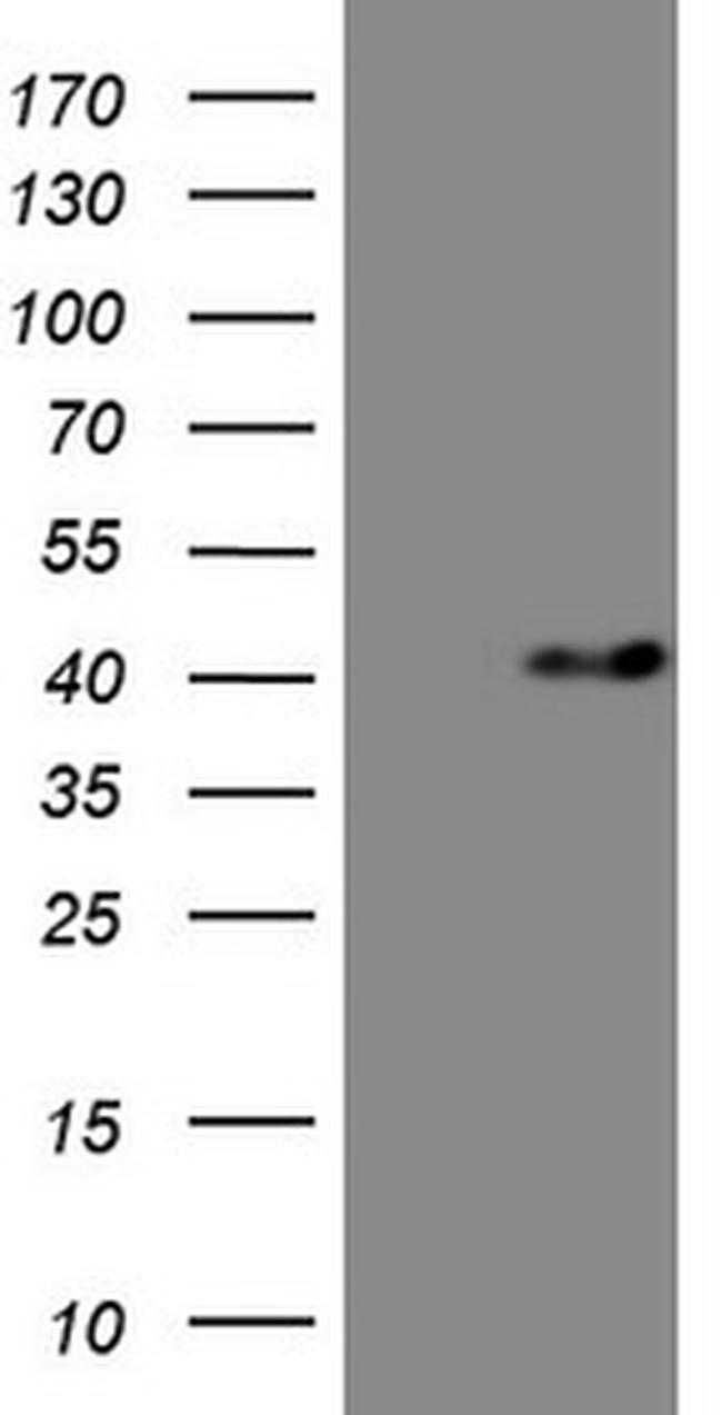 MYOZ1 Antibody in Western Blot (WB)