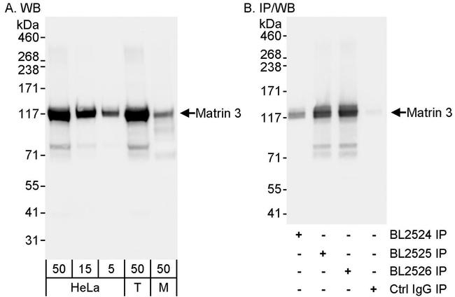 Matrin 3 Antibody in Western Blot (WB)