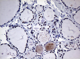 NBN Antibody in Immunohistochemistry (Paraffin) (IHC (P))