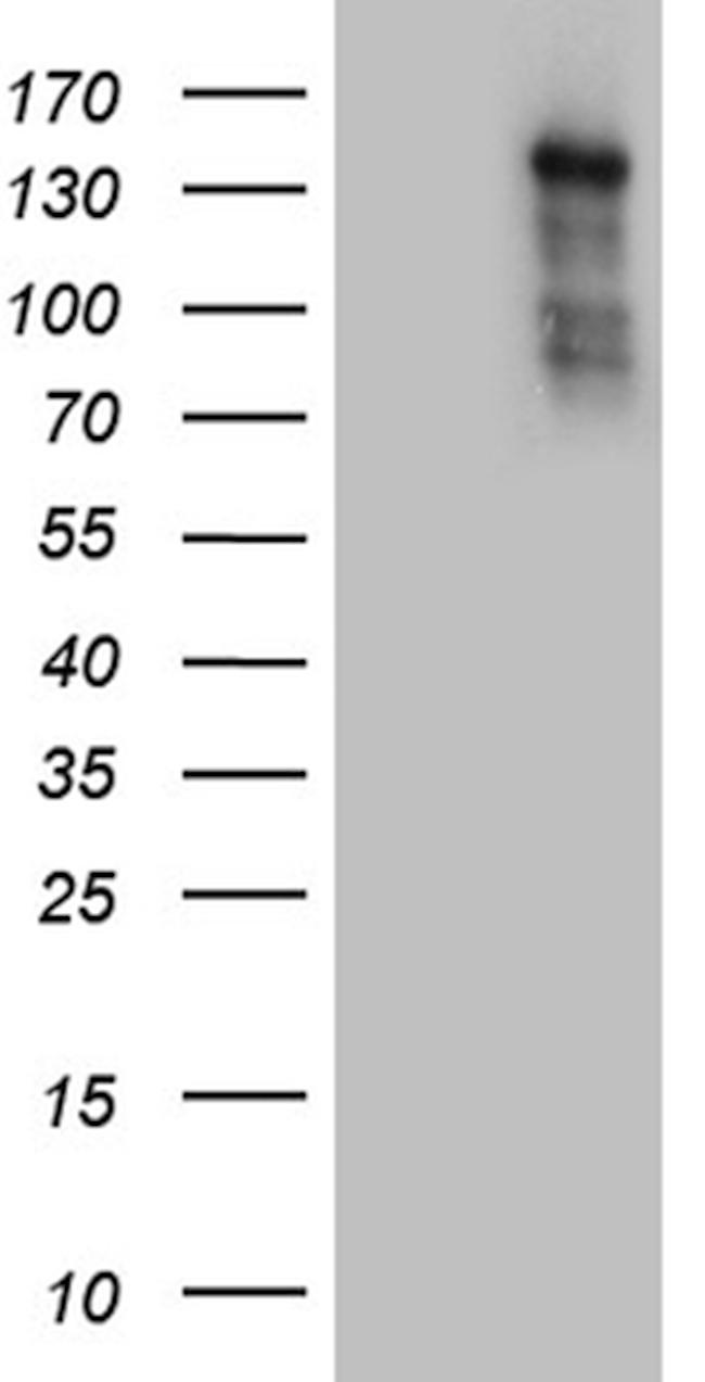 NCOA7 Antibody in Western Blot (WB)