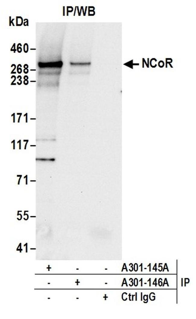 NCoR Antibody in Western Blot (WB)