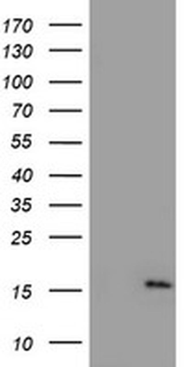 NDUFA5 Antibody in Western Blot (WB)