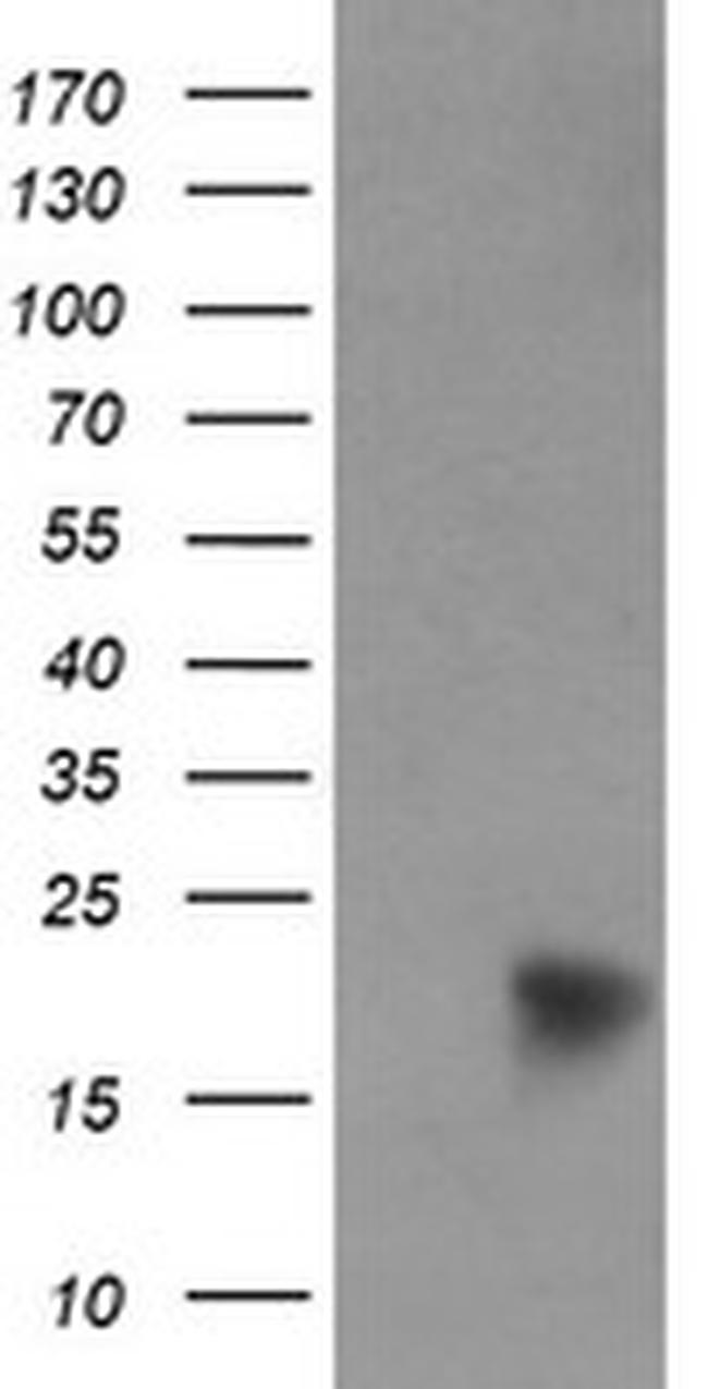NDUFB9 Antibody in Western Blot (WB)