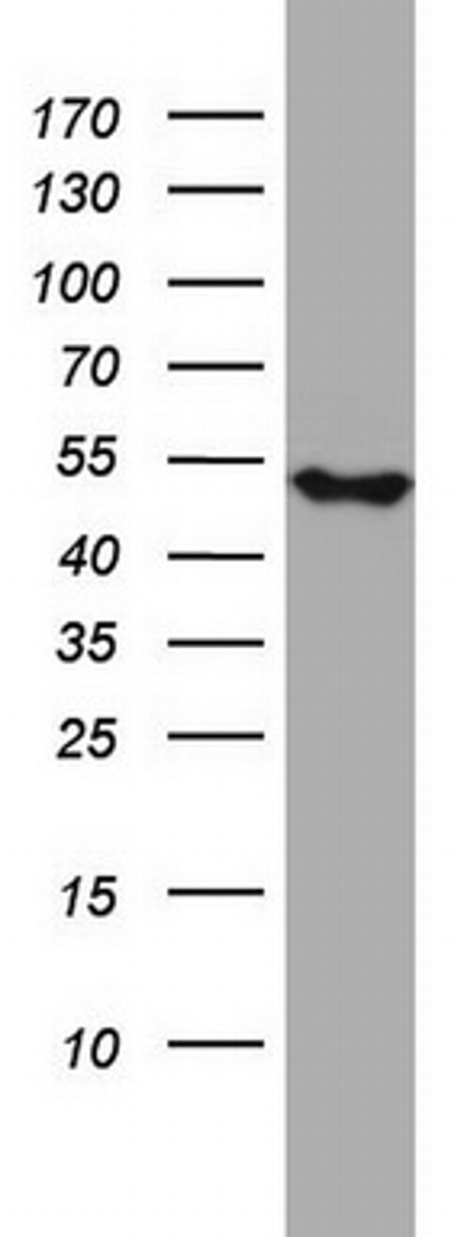 NDUFS2 Antibody in Western Blot (WB)