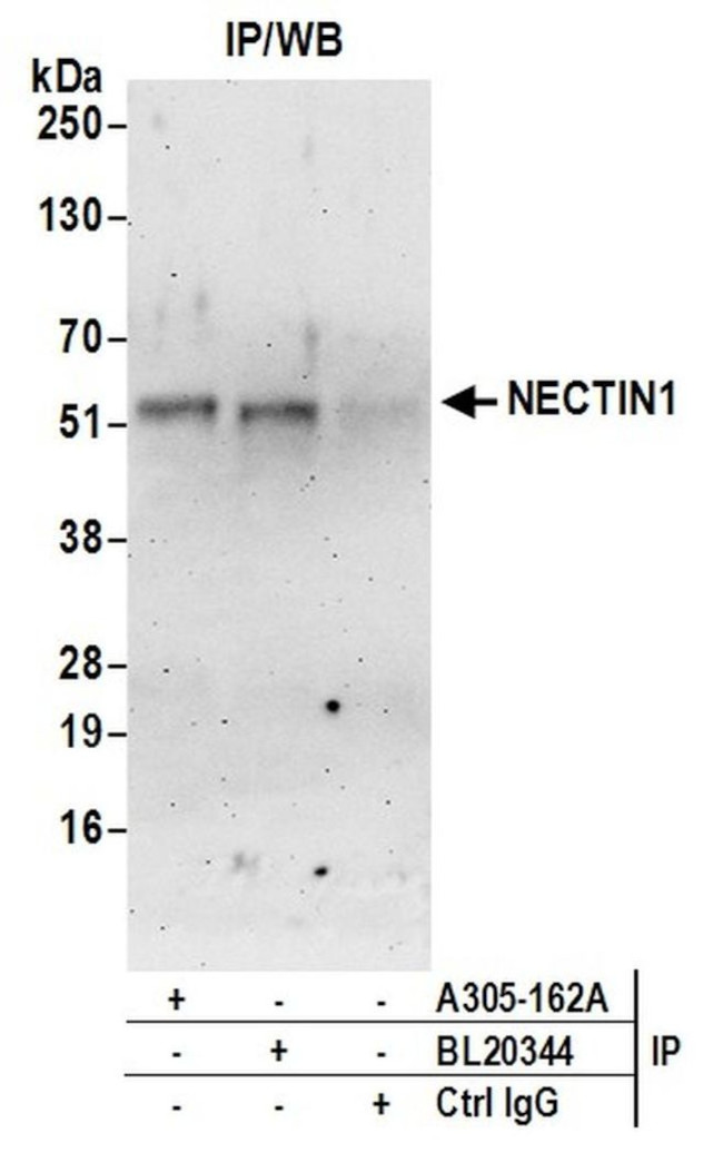 NECTIN1/CD111/PVRL1 Antibody in Immunoprecipitation (IP)
