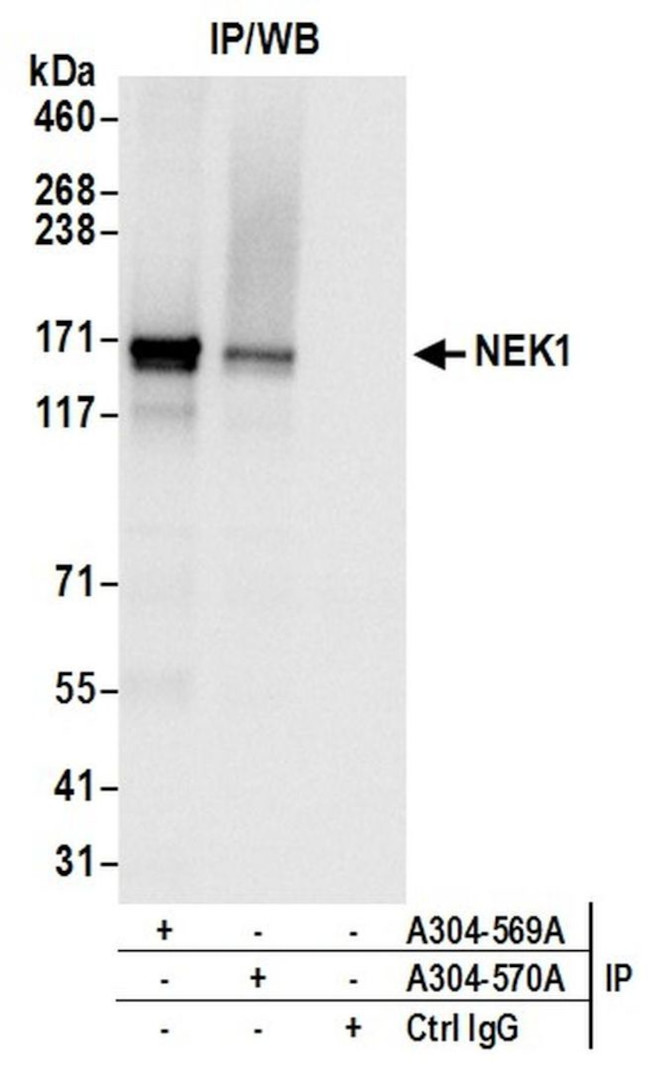 NEK1 Antibody in Immunoprecipitation (IP)