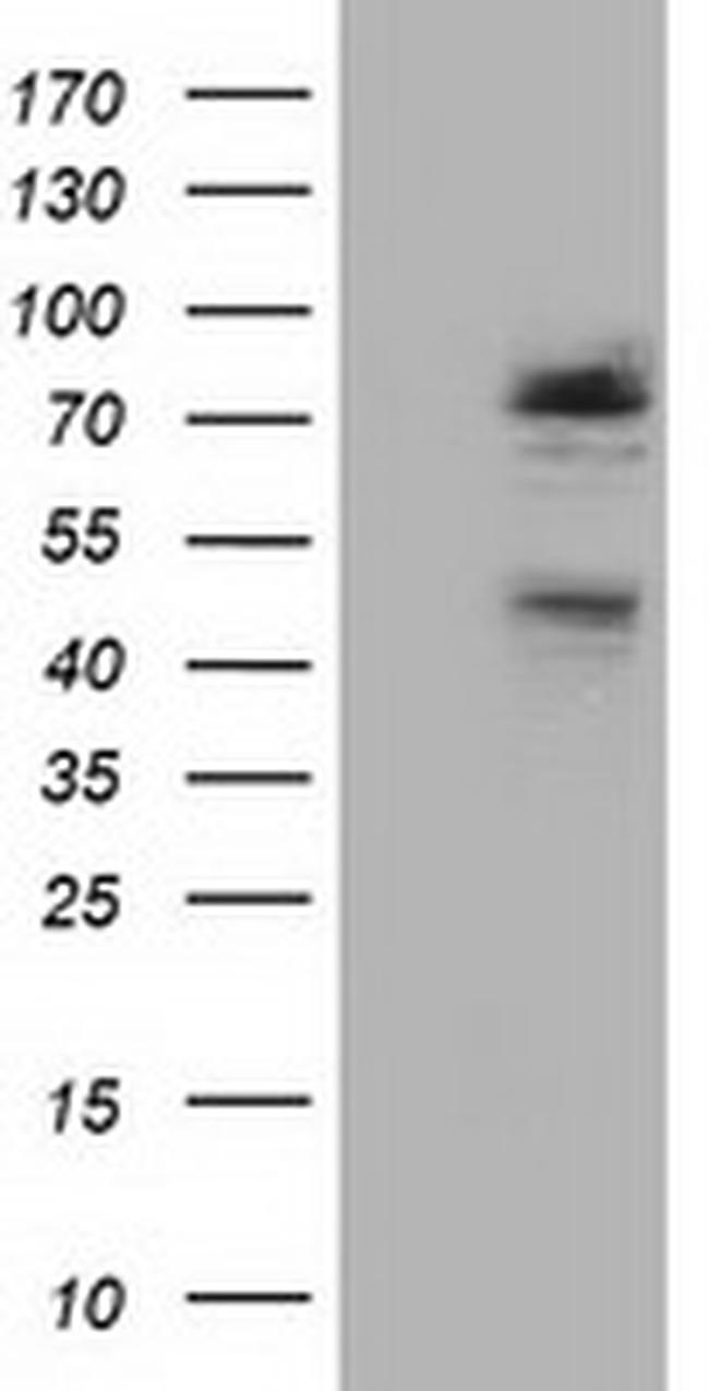NEK11 Antibody in Western Blot (WB)
