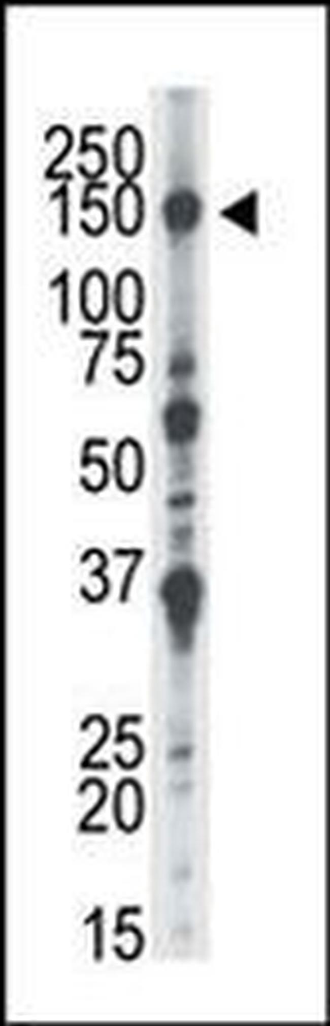 NEK1 Antibody in Western Blot (WB)