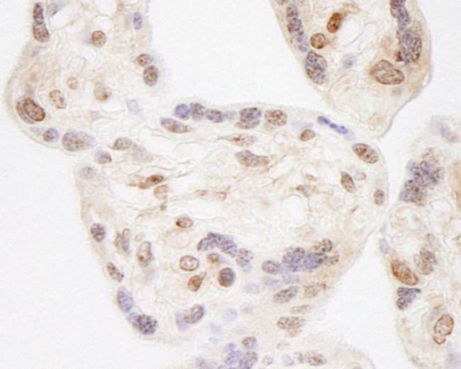 NELFA Antibody in Immunohistochemistry (IHC)