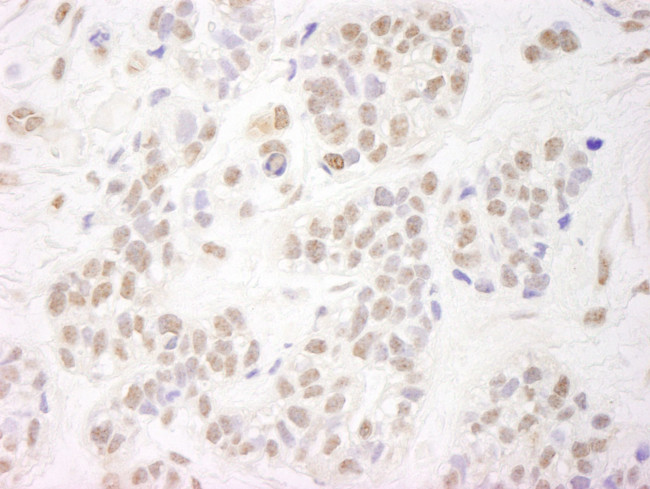NELFA Antibody in Immunohistochemistry (IHC)