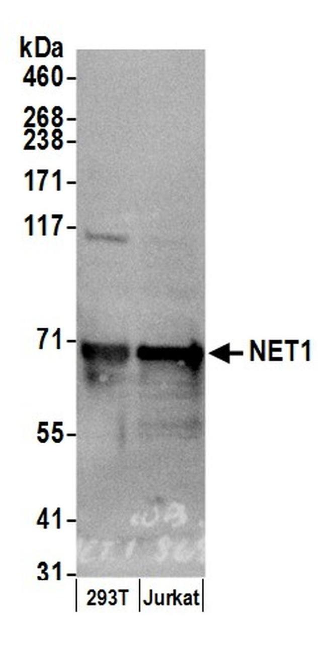 NET1 Antibody in Western Blot (WB)