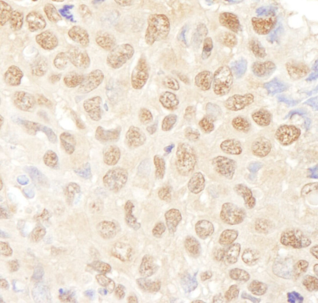 NF-YA Antibody in Immunohistochemistry (IHC)
