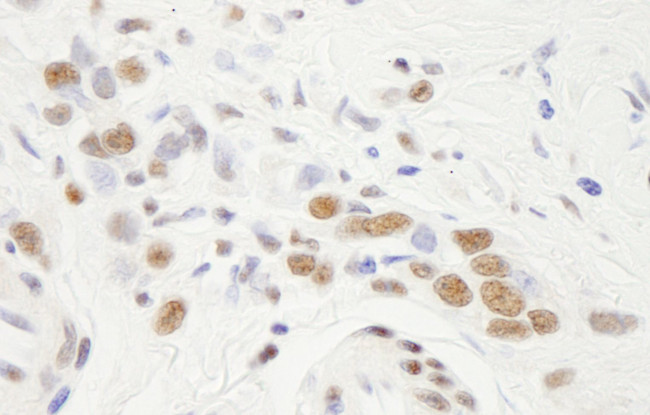 NF-YA Antibody in Immunohistochemistry (IHC)