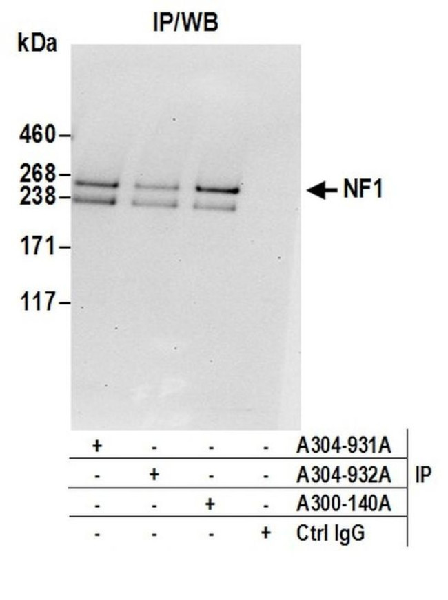 NF1 Antibody in Immunoprecipitation (IP)